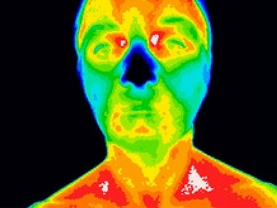 Измерение температуры тела